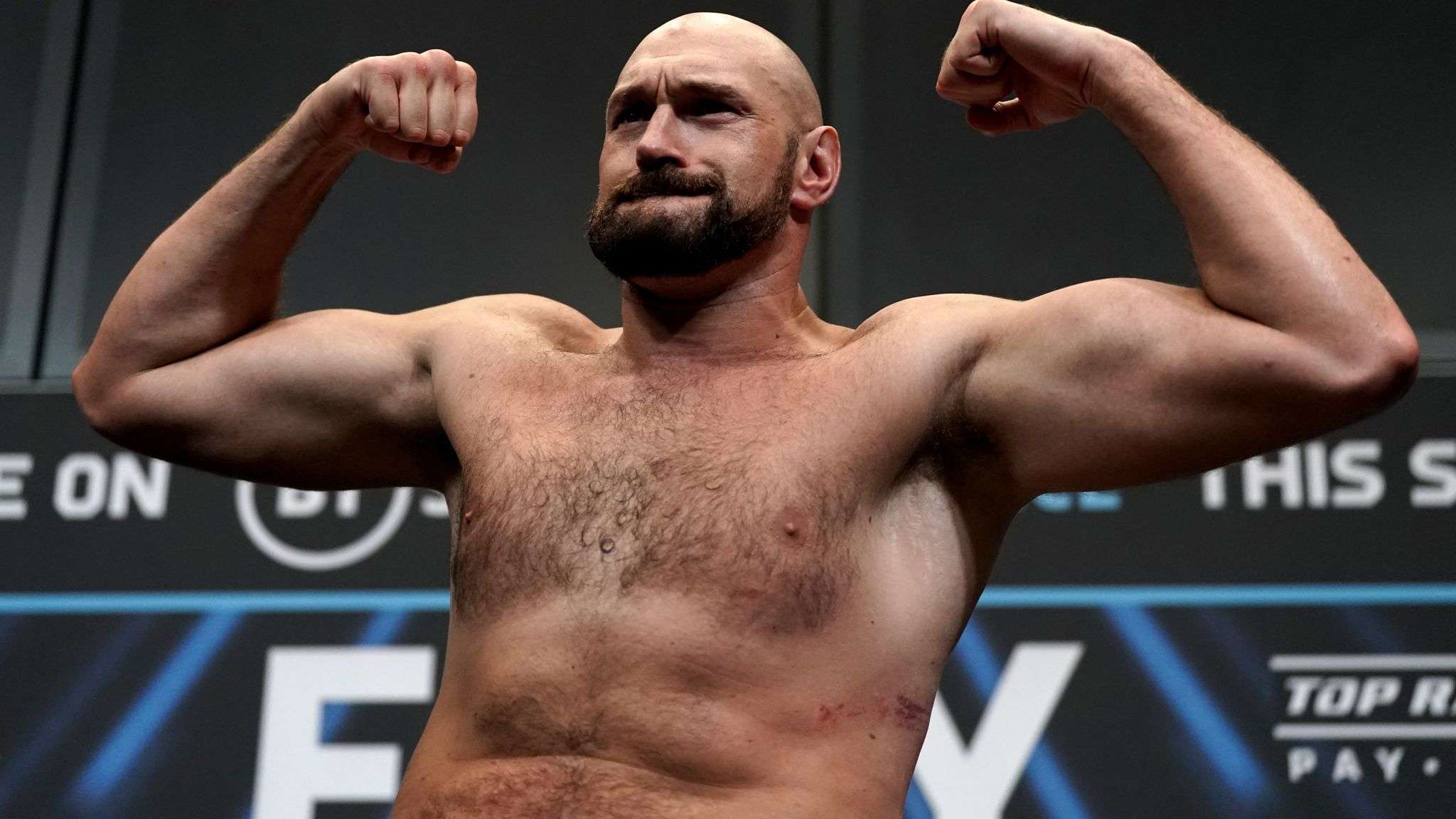 Tyson Fury Image